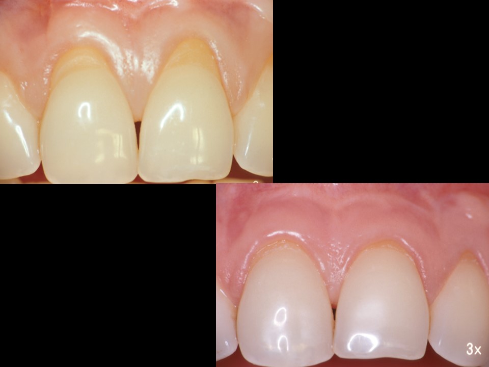 Parodontologie Marseille Cabinet Mattout