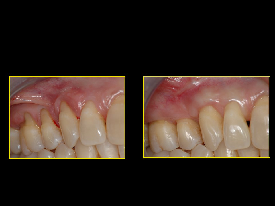 Parodontologie Marseille Cabinet Mattout