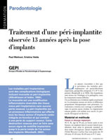 Parodontologie Marseille Cabinet Mattout