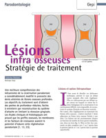 Parodontologie Marseille Cabinet Mattout