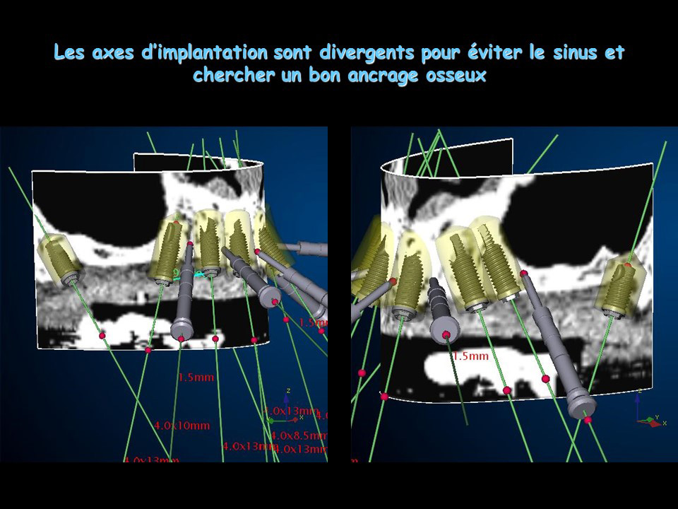 Parodontologie Marseille Cabinet Mattout