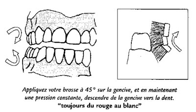 brossage-dent2