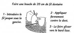brossage-dent3