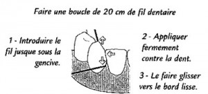 brossage-dent3