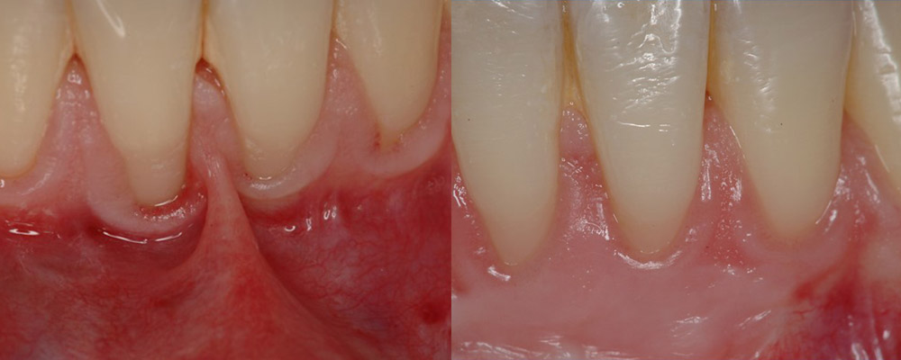 Parodontologie Marseille Cabinet Mattout