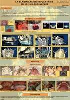 Parodontologie Marseille Cabinet Mattout