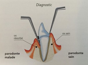 diagnostic