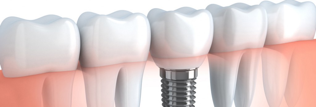 Parodontologie Marseille Cabinet Mattout