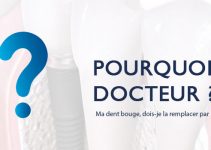 pourquoi-docteur-dent-bouge-implant