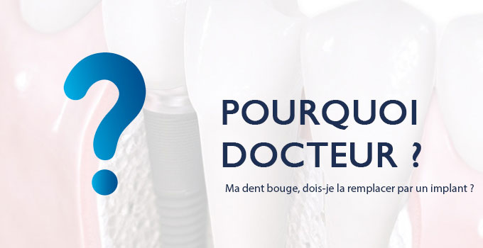 pourquoi-docteur-dent-bouge-implant