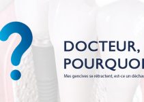 dechaussement-dr-pk